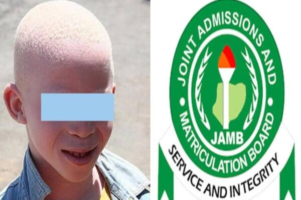 AI: Over 1,500 UTME Candidates Faked Albinism To Bypass Facial Recognition – JAMB