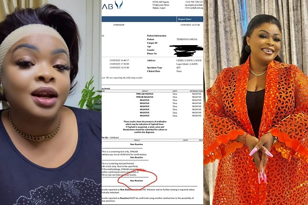 Dayo Amusa Shares HIV Test Result, Urges Fans To Know Their Status