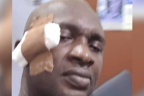 VIDEO: Abia Assembly Majority Leader Smashes Bottle On Colleague’s Head During Fight Over Gov Otti’s Cash Gift