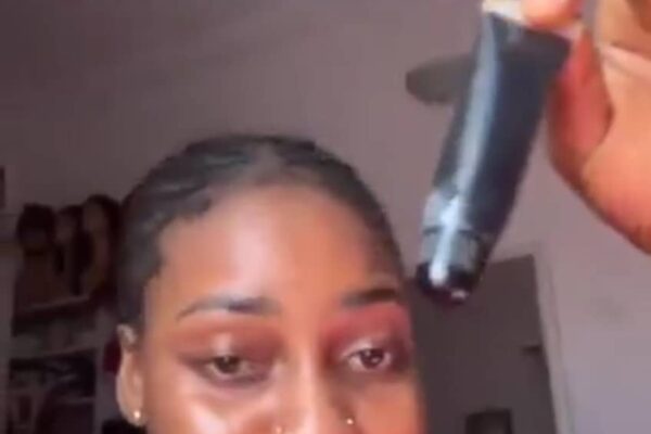 E DON HAPPEN: Nigerian Lady Laments Swelling Lip After Applying Kayamata Gloss (Video)