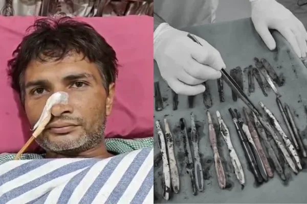 Surgeons Remove 29 Spoons, 19 Toothbrushes, Pens From Patient’s Stomach